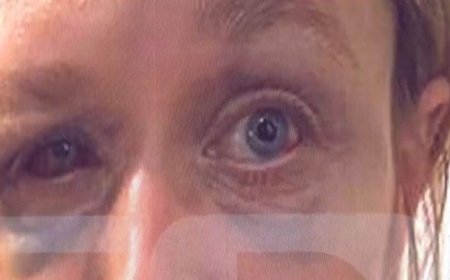 Ξυλοδαρμός Κορωπί: «Έχουμε σχέση αγάπης με τον σύντροφό μου», λέει η 40χρονη