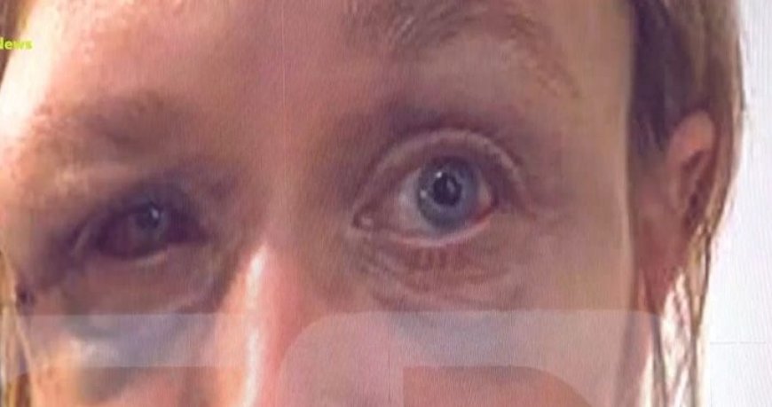 Ξυλοδαρμός Κορωπί: «Έχουμε σχέση αγάπης με τον σύντροφό μου», λέει η 40χρονη