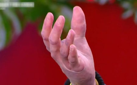 Συγκλόνισε ο Άρης Μουγκοπέτρος: «Εγώ να ψάχνω τα κομμάτια μου και ο άλλος έπαιρνε τη σκούπα και καθάριζε εκεί που ήταν τα δάχτυλά μου»