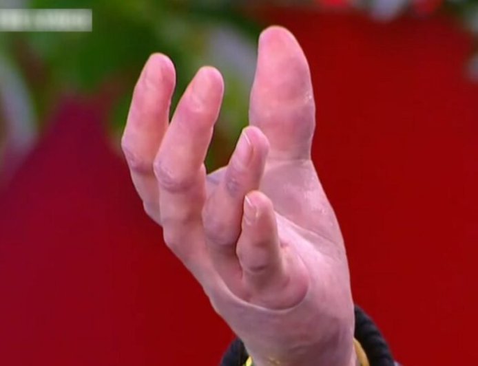 Συγκλόνισε ο Άρης Μουγκοπέτρος: «Εγώ να ψάχνω τα κομμάτια μου και ο άλλος έπαιρνε τη σκούπα και καθάριζε εκεί που ήταν τα δάχτυλά μου»