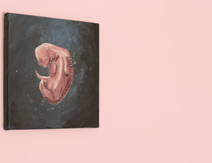 Απαγόρευση αμβλώσεων ΗΠΑ: Μία ακόμα Πολιτεία προστέθηκε στη λίστα